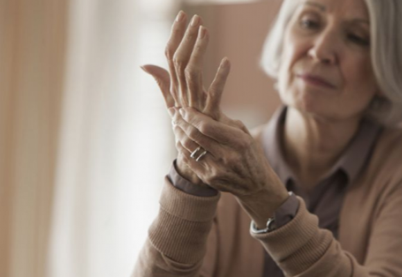 dealing with arthritis