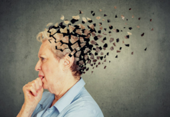 Alzheimer's Disease